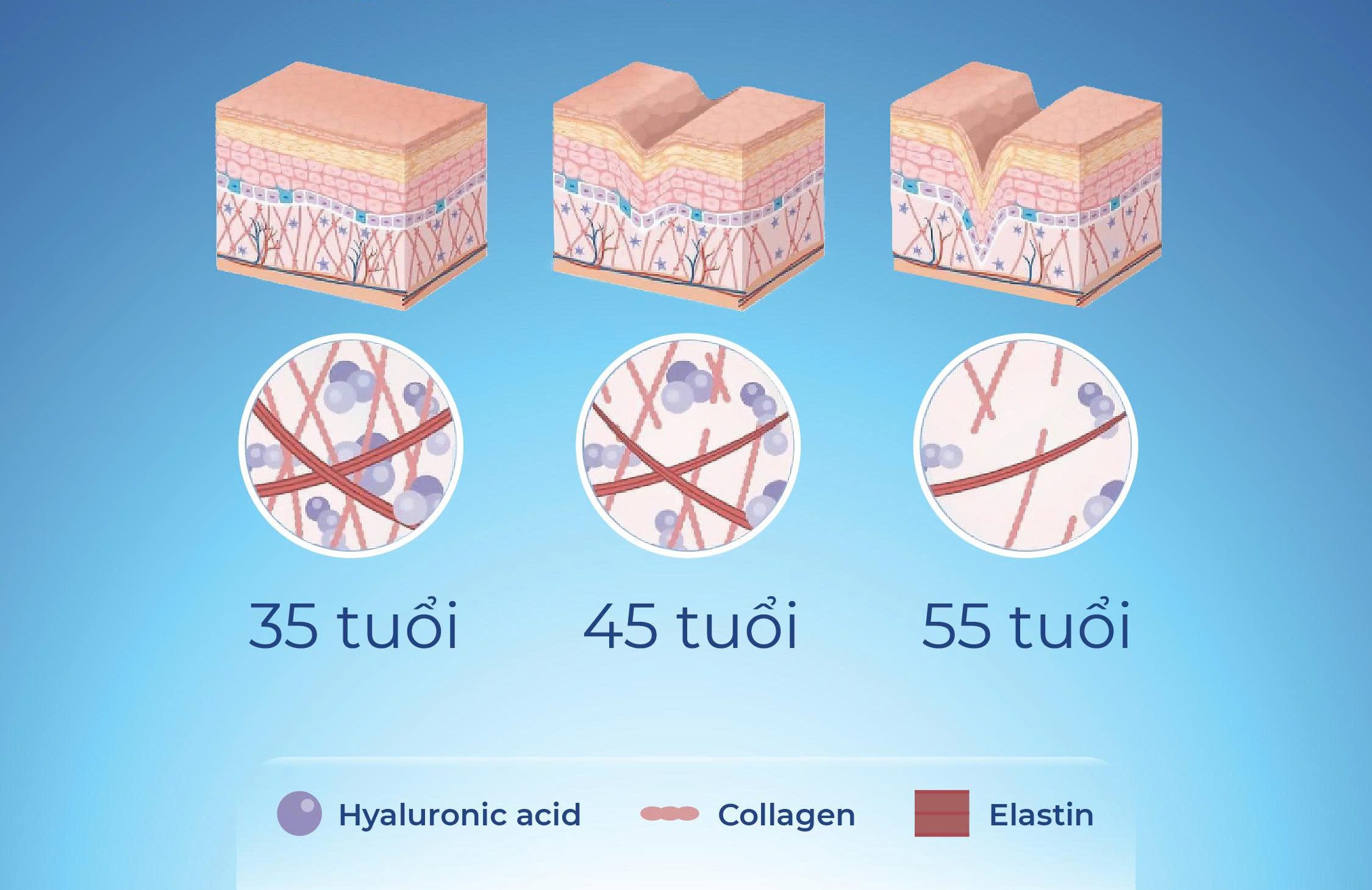 Collagen - Hyaluronic Acid - Glucosamine: Bộ 3 dưỡng chất "nâng cơ" trẻ hoá làn da từ gốc