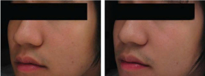 Uống Glutathione trắng da – 1 tháng liệu đã có hiệu quả chưa? Cùng xem kết quả từ nghiên cứu hàng đầu với Alka Wellness nhé